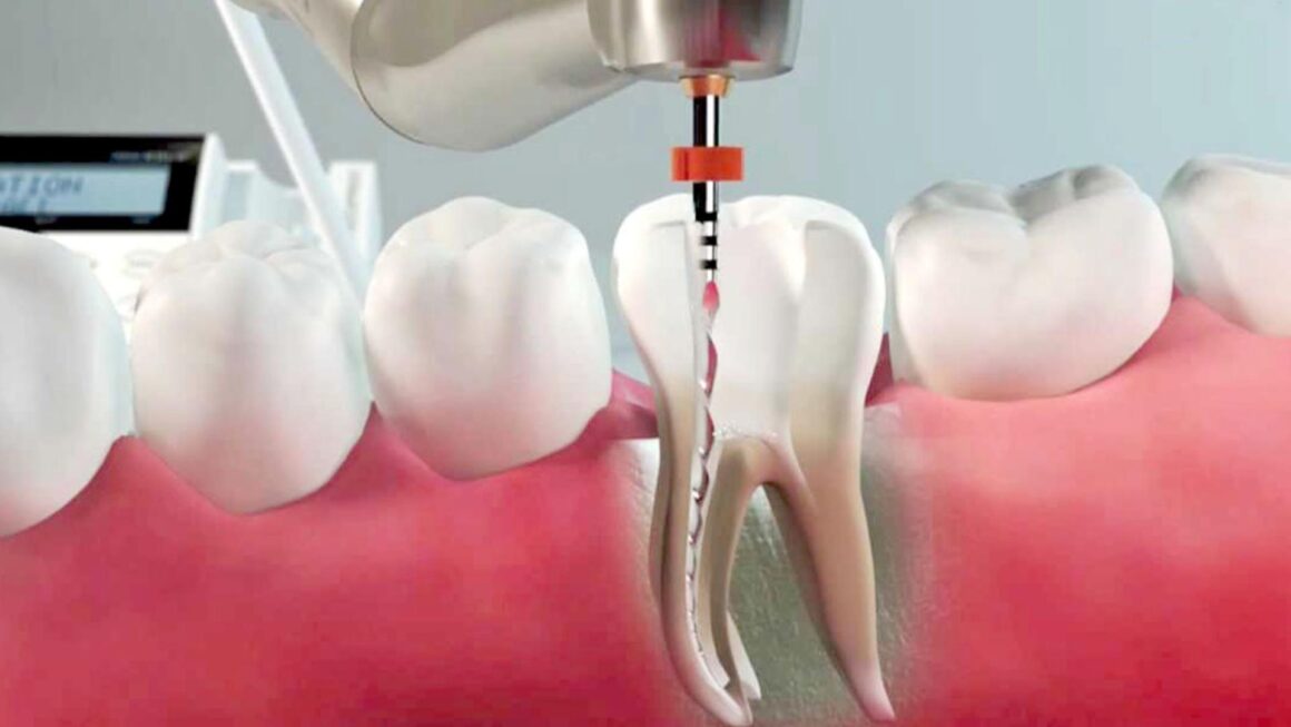 Endodonzia