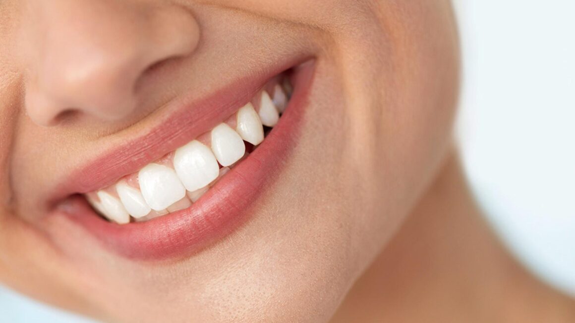 estetica dentale Estetica